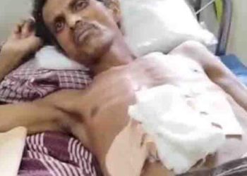 മർദ്ദനം നേരിട്ടയാൾ ഗുരുതരാവസ്ഥയിൽ;പോലീസിനെതിരെ അന്വേഷണത്തിന് ഉത്തരവ്