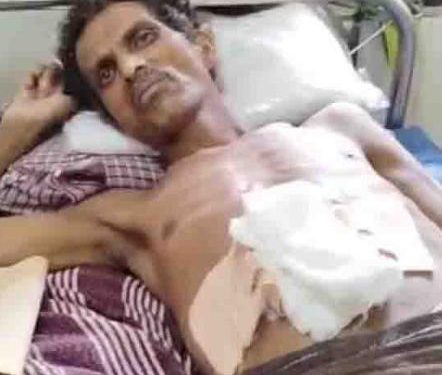 മർദ്ദനം നേരിട്ടയാൾ ഗുരുതരാവസ്ഥയിൽ;പോലീസിനെതിരെ അന്വേഷണത്തിന് ഉത്തരവ്