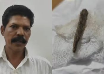 ചികിത്സാപ്പിഴവ്; തുന്നിക്കെട്ടിയ മുറിവില്‍ നിന്ന് 5 മാസത്തിന് ശേഷം മരച്ചീള് കണ്ടെത്തി