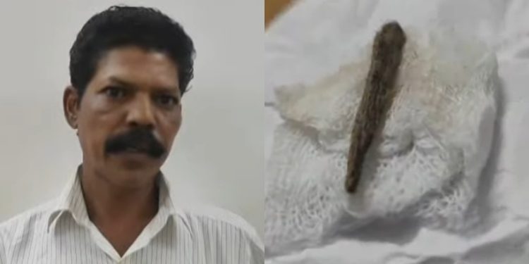 ചികിത്സാപ്പിഴവ്; തുന്നിക്കെട്ടിയ മുറിവില് നിന്ന് 5 മാസത്തിന് ശേഷം മരച്ചീള് കണ്ടെത്തി