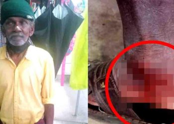 വീണ്ടും തെരുവുനായയുടെ ആക്രമണം;വയോധികന് കടിയേറ്റു