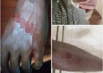 പൊഴുതനയിൽ വീണ്ടും തെരുവുനായ ആക്രമണം