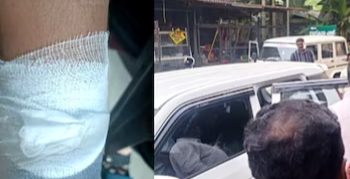 കുഞ്ഞിനോട് ക്രൂരത: ചാർജറിന്റെ വയർ കൊണ്ട് അടിച്ചു, ഇസ്തിരിപ്പെട്ടി ചൂടാക്കി പൊള്ളലേൽപ്പിച്ചു; രണ്ടാനച്ഛൻ അറസ്റ്റിൽ