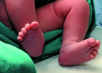 വായില്‍ കല്ലുനിറച്ച് ചുണ്ട് പശവെച്ച് ഒട്ടിച്ചു; നവജാതശിശുവിനെ വനത്തില്‍ ഉപേക്ഷിച്ച നിലയില്‍