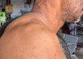 തെരുവുനായ ആക്രമണം: മധ്യവയസ്കന് പരിക്ക്