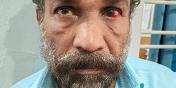 ഹൈവേ റോബറി:സഹായി പിടിയില്‍