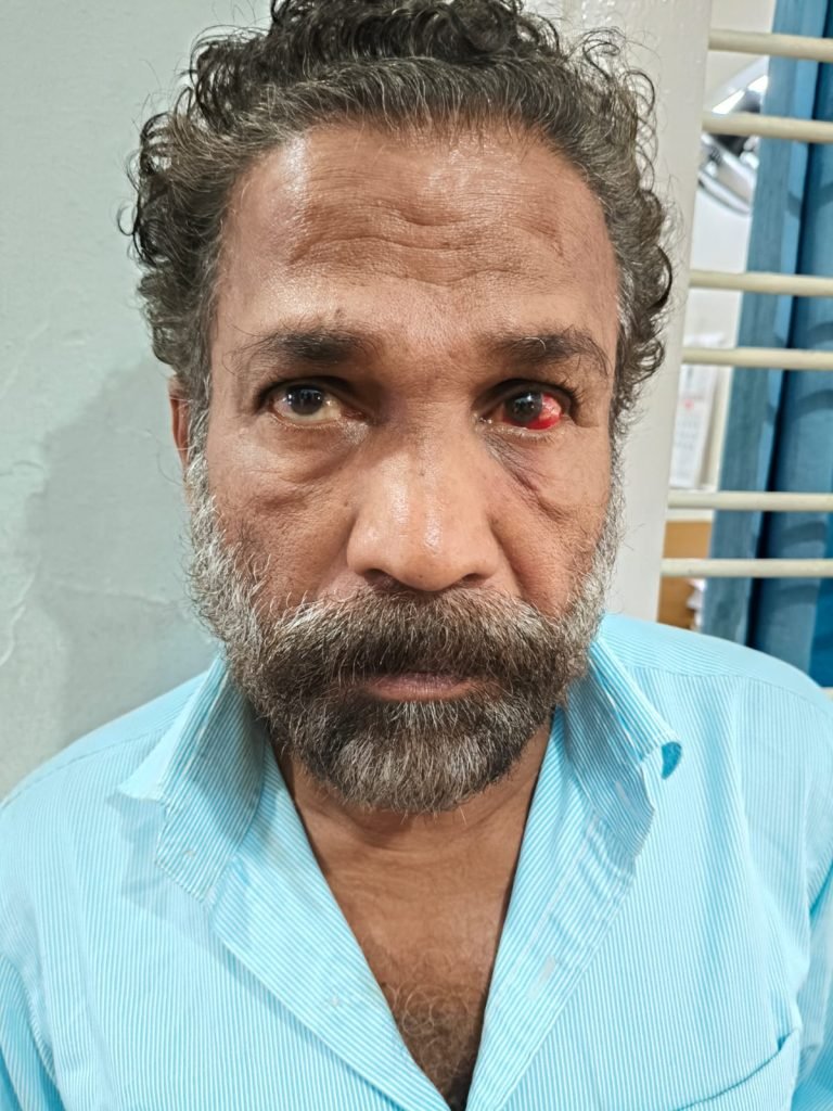 ഹൈവേ റോബറി:സഹായി പിടിയില്‍