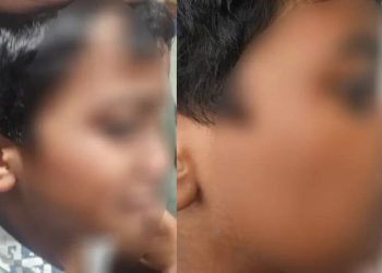 ചികിത്സയ്ക്കിടെ ഡോക്ടർ ഏഴുവയസ്സുകാരനെ മർദിച്ചതായി പരാതി; ഡോക്ടറെ അച്ഛൻ മർദിച്ചെന്ന് ആശുപത്രിയും