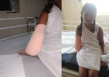 കെട്ടഴിച്ചപ്പോൾ രക്തയോട്ടം നിലച്ചിരുന്നു, കൈ വളരുമെന്ന വിചാരത്തിലാണ് അവൾ’; വേദനയിൽ കുടുംബം, തിരിഞ്ഞുനോക്കാതെ സർക്കാർ