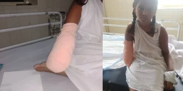 കെട്ടഴിച്ചപ്പോൾ രക്തയോട്ടം നിലച്ചിരുന്നു, കൈ വളരുമെന്ന വിചാരത്തിലാണ് അവൾ’; വേദനയിൽ കുടുംബം, തിരിഞ്ഞുനോക്കാതെ സർക്കാർ