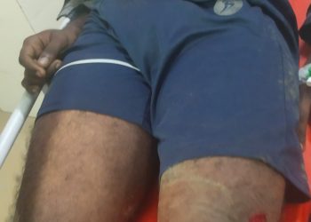 കാട്ടാനയുടെ ആക്രമണത്തിൽ  യുവാവിന് ഗുരുതര പരിക്ക്