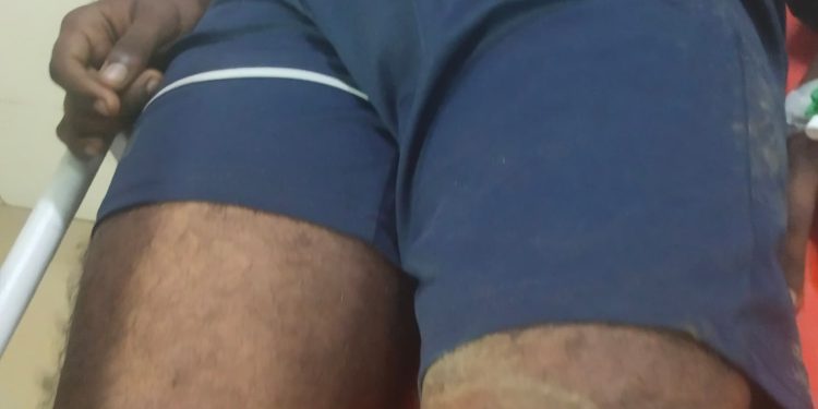 കാട്ടാനയുടെ ആക്രമണത്തിൽ യുവാവിന് ഗുരുതര പരിക്ക്