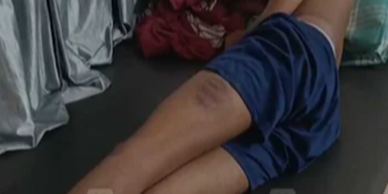 പ്ലസ് ടു വിദ്യാർഥികളെ അധ്യാപകനും സുഹൃത്തുക്കളും ക്രൂരമായി മർദിച്ചു