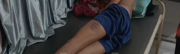 പ്ലസ് ടു വിദ്യാർഥികളെ അധ്യാപകനും സുഹൃത്തുക്കളും ക്രൂരമായി മർദിച്ചു