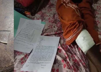 ചില്ലു നീക്കാതെ മുറിവ് തുന്നിക്കെട്ടി, വേദന സഹിച്ചത് അഞ്ചു മാസം; വണ്ടാനം മെഡിക്കല്‍ കോളജിനെതിരെ പരാതി