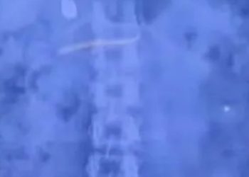 കുഞ്ഞിനെ ലാളിക്കുന്നതിനിടെ സ്വര്‍ണമാല വിഴുങ്ങി; യുവതി പിടിയില്‍