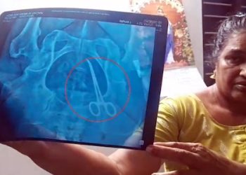 വയറിൽ കത്രികയുമായി 5 കൊല്ലം, വീട്ടമ്മയെ ഗുളിക കൊടുത്തു മടക്കി