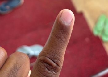 വോട്ട് രേഖപ്പെടുത്തിയ ശേഷം കൈ കഴുകിയപ്പോൾ മഷി അടയാളം മാഞ്ഞു പോയതായി പരാതി