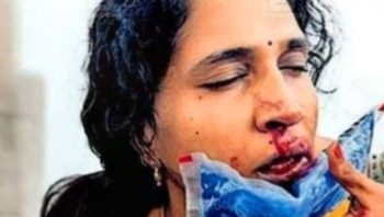 ക്ലാസിൽ ഗെയിം കളിക്കരുതെന്ന് താക്കീത്; അധ്യാപികയുടെ മൂക്കിടിച്ചു പരത്തി വിദ്യാർഥി