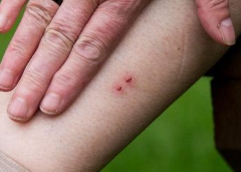 ‘ആന്റിവെനത്തില്‍ വീഴ്ച പാടില്ല, കൃത്യമായ ചികിത്സ നല്‍കണം’; ഡിഎംഒമാര്‍ക്ക് നിര്‍ദേശം