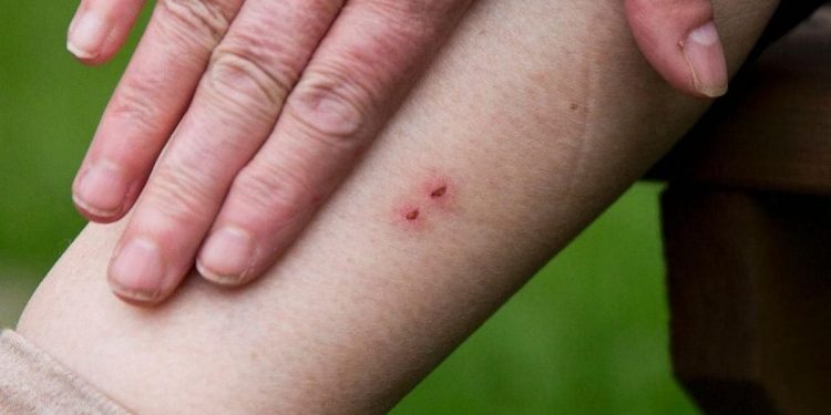 ‘ആന്റിവെനത്തില്‍ വീഴ്ച പാടില്ല, കൃത്യമായ ചികിത്സ നല്‍കണം’; ഡിഎംഒമാര്‍ക്ക് നിര്‍ദേശം