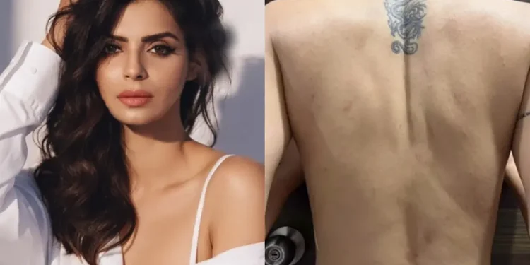 ഭക്ഷണത്തിൽ പാറ്റകൾ, ചത്ത എലികൾ, ചർമരോഗം ബാധിച്ചു; മറാത്തി ബിഗ് ബോസിനെതിരെ ഗുരുതര ആരോപണങ്ങളുമായി നടി