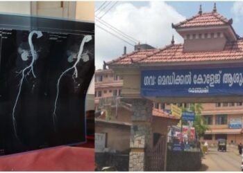 കാല് വേദനയുമായി എത്തി; ശസ്ത്രക്രിയയിൽ രോഗിയുടെ കാലിന്റെ ഞരമ്പുകൾ മുറിച്ചു മാറ്റി, മഞ്ചേരി മെഡിക്കൽ കോളജിൽ ഗുരുതര ചികിത്സാ പിഴവ്