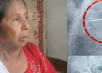 കുത്തിവെപ്പെടുത്തപ്പോള്‍ സൂചി ഒടിഞ്ഞു, ദുരിതവുമായി വത്സല കഴിഞ്ഞത് ഒരു വര്‍ഷം