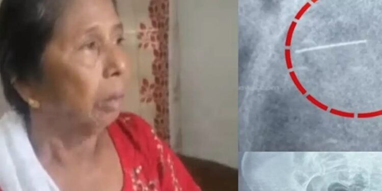 കുത്തിവെപ്പെടുത്തപ്പോള്‍ സൂചി ഒടിഞ്ഞു, ദുരിതവുമായി വത്സല കഴിഞ്ഞത് ഒരു വര്‍ഷം