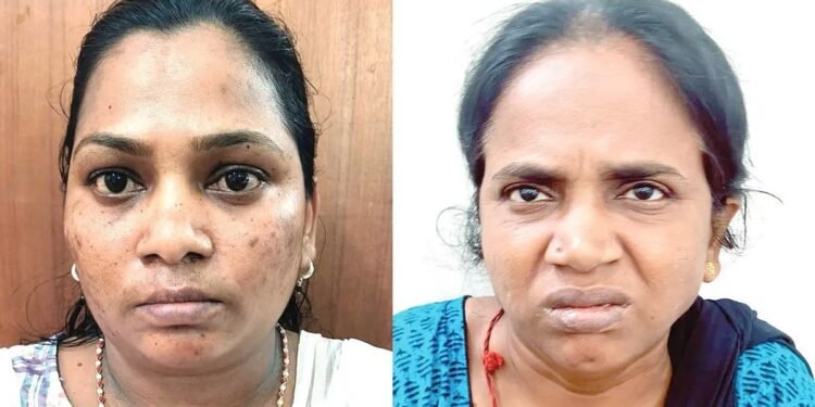 തലേദിവസം വീട്ടിലെത്തി ഒളിച്ചിരുന്നു, ആണ്വേഷം കെട്ടി 10 പവന് പിടിച്ചുപറിച്ചു, കിടപ്പുരോഗിയുടെ സ്വര്ണം കവര്ന്നത് ഹോം നഴ്സും സുഹൃത്തും